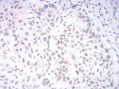 Anti-KDM1B Antibody (3V868)