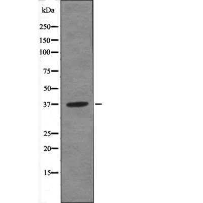 Anti-Phospho-ANXA1 (Tyr21) Polyclonal Antibody 2