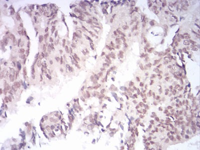 Anti-KDM1B Antibody (3V868)
