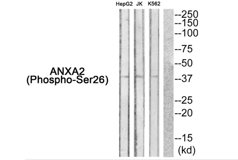 Anti-Phospho-ANXA2 (Ser26) Polyclonal Antibody