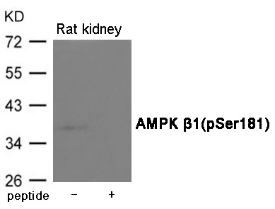 Anti-Phospho-AMPK β1 (Ser181) Polyclonal Antibody