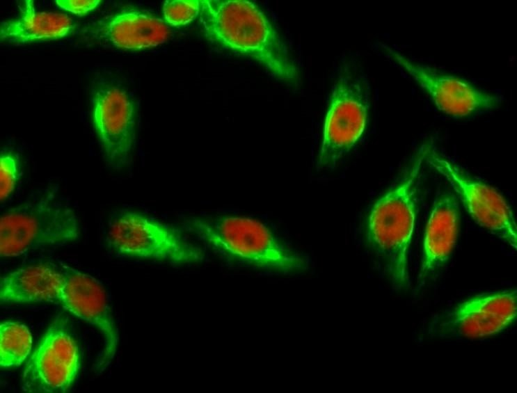 Anti-Phospho-AMPKα1/2 (Thr183/172) Polyclonal Antibody 2