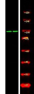 Anti-Phospho-Androgen receptor (Ser308) Polyclonal Antibody