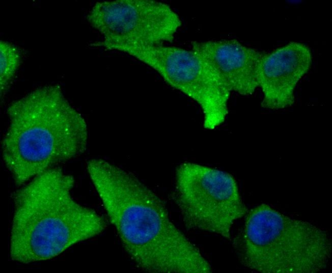 Anti-ANXA4 Antibody (3T392)