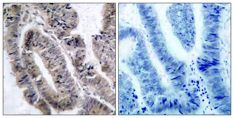 Anti-Phospho-AMPK α1 (Ser496) Polyclonal Antibody 2