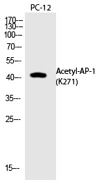 Anti-Acetyl-JUN (Lys271) Polyclonal Antibody