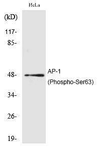 Anti-Phospho-JUN (Ser63) Polyclonal Antibody 2