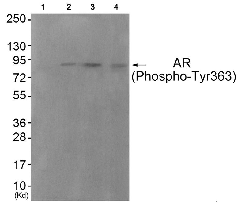 Anti-Phospho-Androgen receptor (Tyr363) Polyclonal Antibody 2