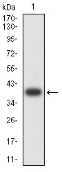 Anti-AP2 beta Antibody (6Y40)