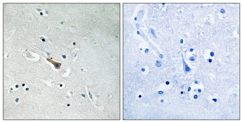 Anti-Phospho-APLP2 (Tyr755) Polyclonal Antibody