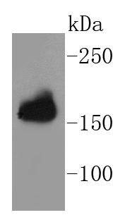 Anti-APC Antibody (8V676)