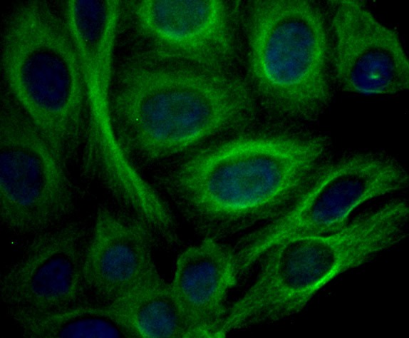 Anti-Apolipoprotein A-II/APOA2 Antibody (7V111)