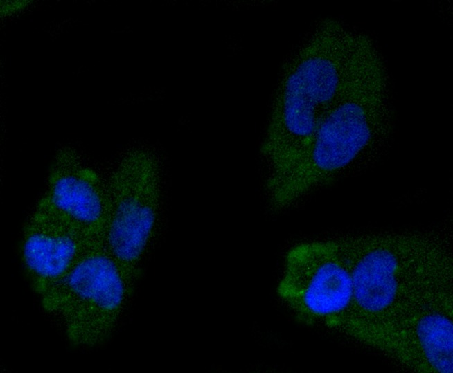 Anti-Apolipo A-I/APOA1 Antibody (2Q549)