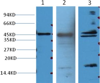Anti-Aquaporin-4/AQP4 Antibody (3I508)