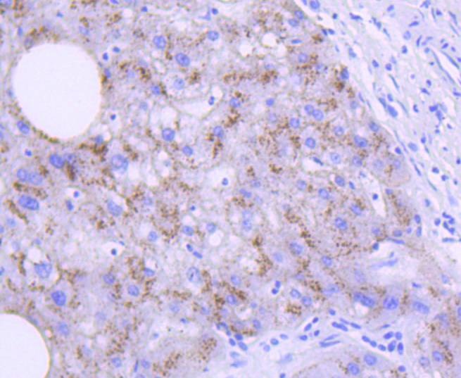Anti-Apolipo E/APOE3 Antibody (7Q652)
