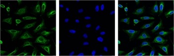 Anti-Aquaporin-4/AQP4 Antibody (3I508)