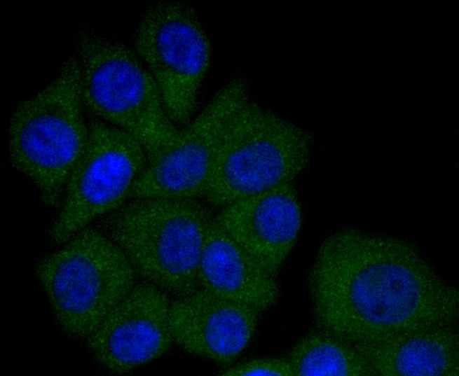 Anti-Apolipo A-I/APOA1 Antibody (2Q549)