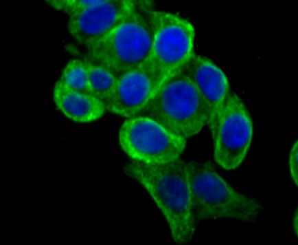 Anti-Apolipoprotein A-II/APOA2 Antibody (7V111)