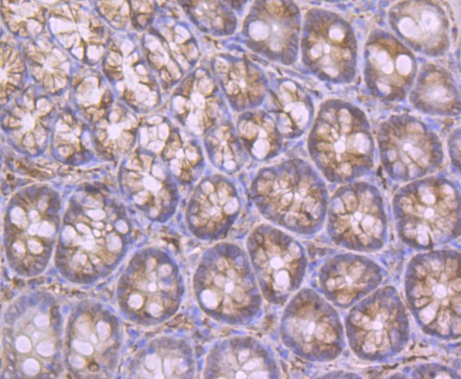 Anti-Apolipoprotein A-II/APOA2 Antibody (7V111)