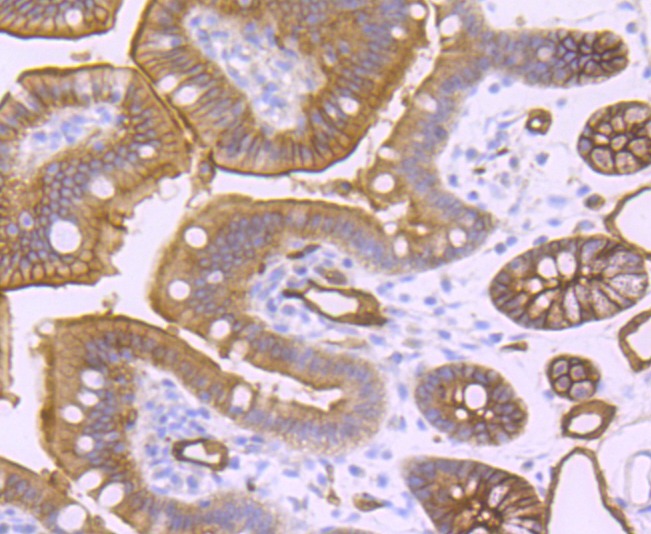 Anti-Aquaporin-1/AQP1 Antibody (3P252)
