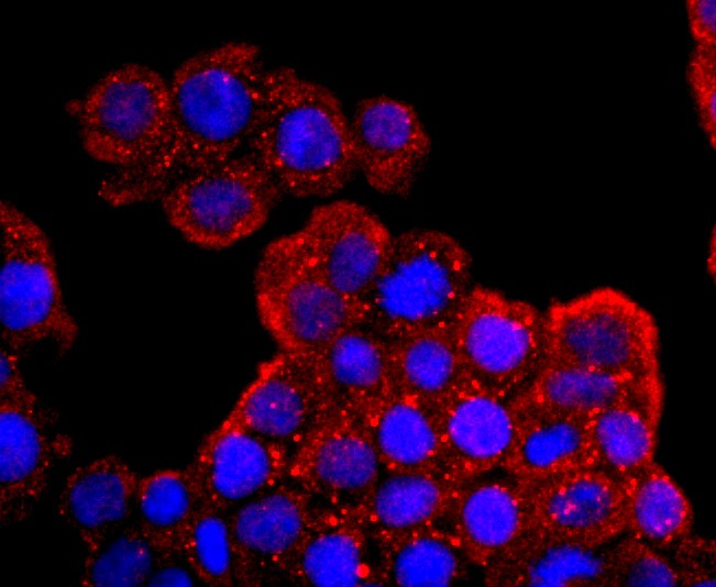Anti-Aquaporin-1/AQP1 Antibody (3P252)