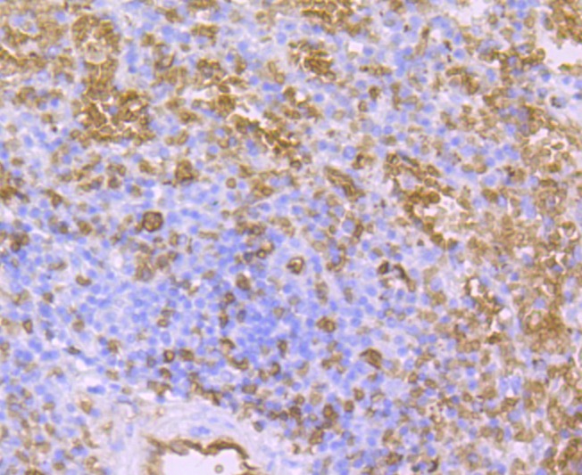 Anti-Aquaporin-1/AQP1 Antibody (3P252)