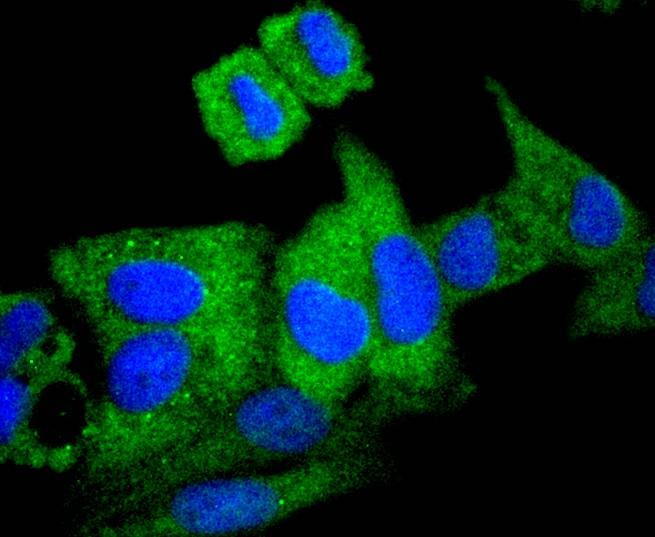 Anti-Apg7 Antibody (7C583)