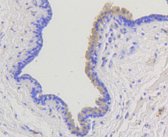 Anti-ARRB1 Antibody (3Y284)