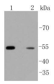 Anti-ARRB1 Antibody (3Y284)