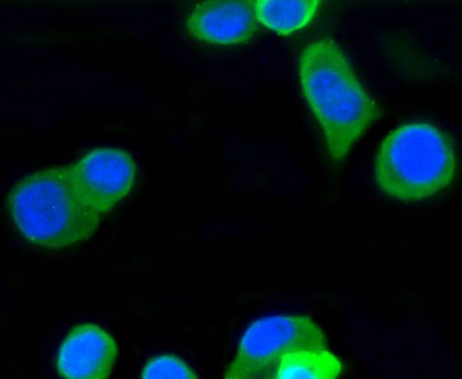Anti-TUBB Antibody (7E2)