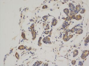 Anti-BCL2 Antibody (4G452)