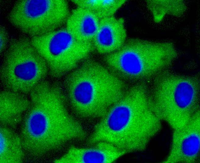 Anti-ARRB1 Antibody (3Y284)