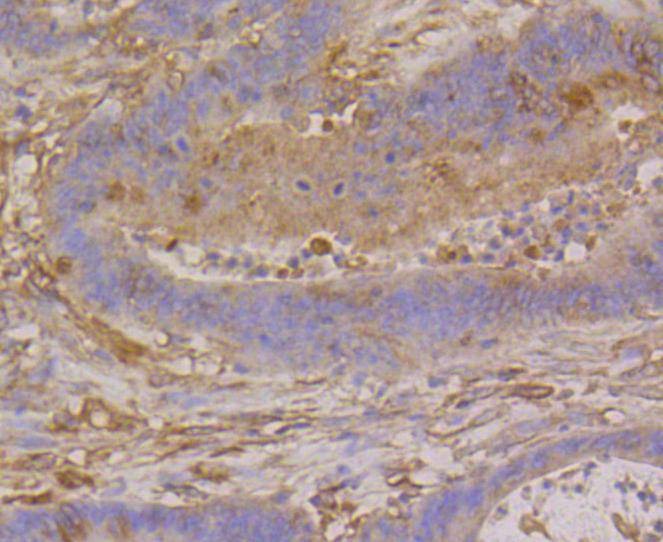 Anti-TUBB Antibody (7E2)