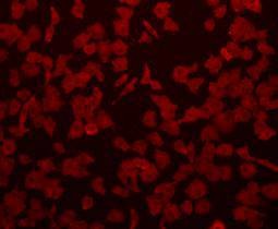 Anti-Beta-Actin Antibody (1R828)