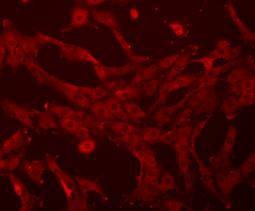 Anti-Beta-Actin Antibody (1R828)