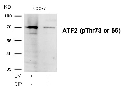 Anti-Phospho-ATF2 (Thr73 or 55) Polyclonal Antibody