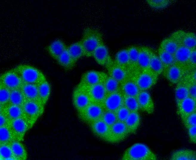 Anti-ARRB1 Antibody (3Y284)