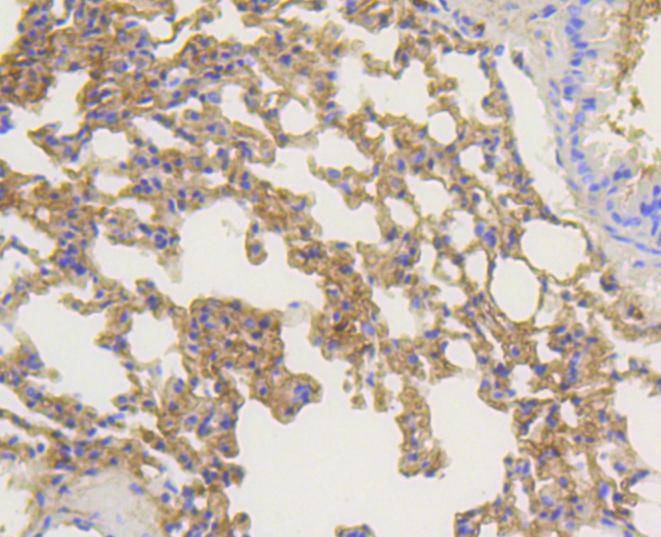 Anti-ARRB1 Antibody (3Y284)