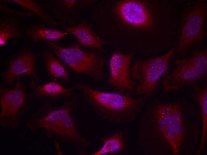 Anti-Phospho-ATF2 (Thr73 or 55) Polyclonal Antibody