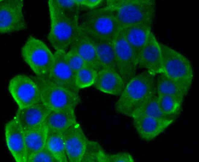 Anti-TUBB Antibody (7E2)