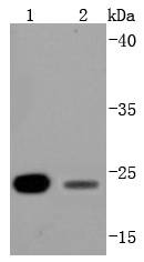 Anti-BCL2 Antibody (9S932)