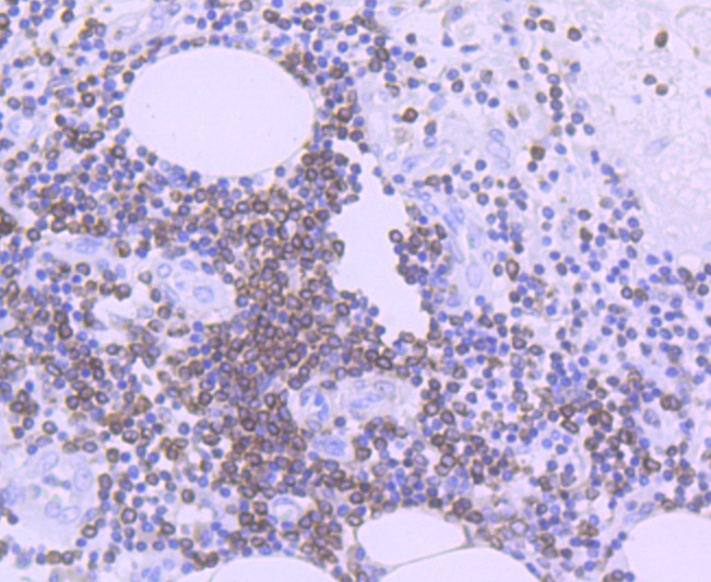 Anti-BCL2 Antibody (4Z465)