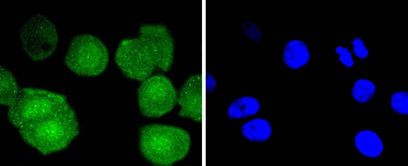 Anti-BCL2 Antibody (9S932)