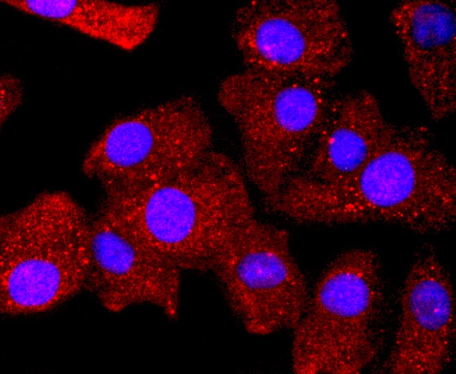 Anti-BCL2 Antibody (4Z465)
