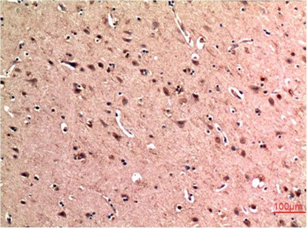 Anti-Beclin-1 Antibody (7N816)