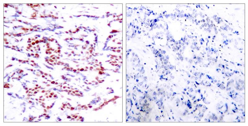 Anti-Phospho-ATF2 (Thr71 or 53) Polyclonal Antibody