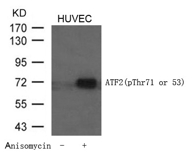 Anti-Phospho-ATF2 (Thr71 or 53) Polyclonal Antibody