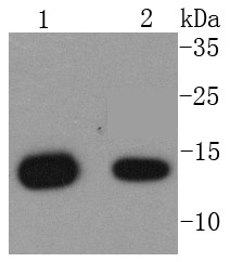 Anti-B2M/beta 2-Microglobulin Antibody (1O957)