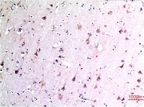Anti-Beclin-1 Antibody (2S272)