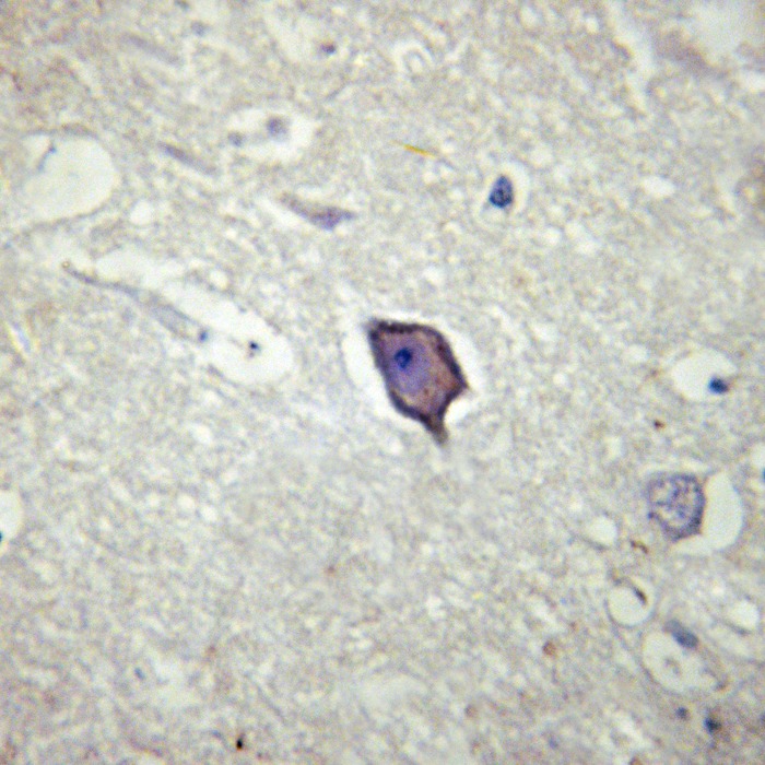 Anti-Phospho-Beta-NaCH (Thr615) Polyclonal Antibody